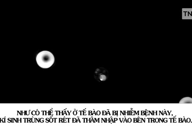 Xem kí sinh trùng sốt rét dùng “chiêu trò” để vô hiệu hóa hệ miễn dịch