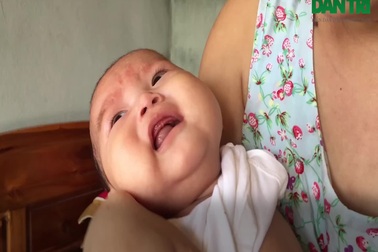 Bé gái 5 tháng tuổi khát sữa chống chọi với căn bệnh ung thư