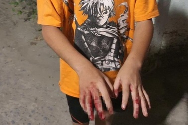 Cha đánh con chảy máu tay vì chơi game: Phương pháp giáo dục này có đúng?