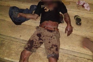 Mâu thuẫn trong cuộc nhậu, hai thanh niên chém nhau loạn xạ