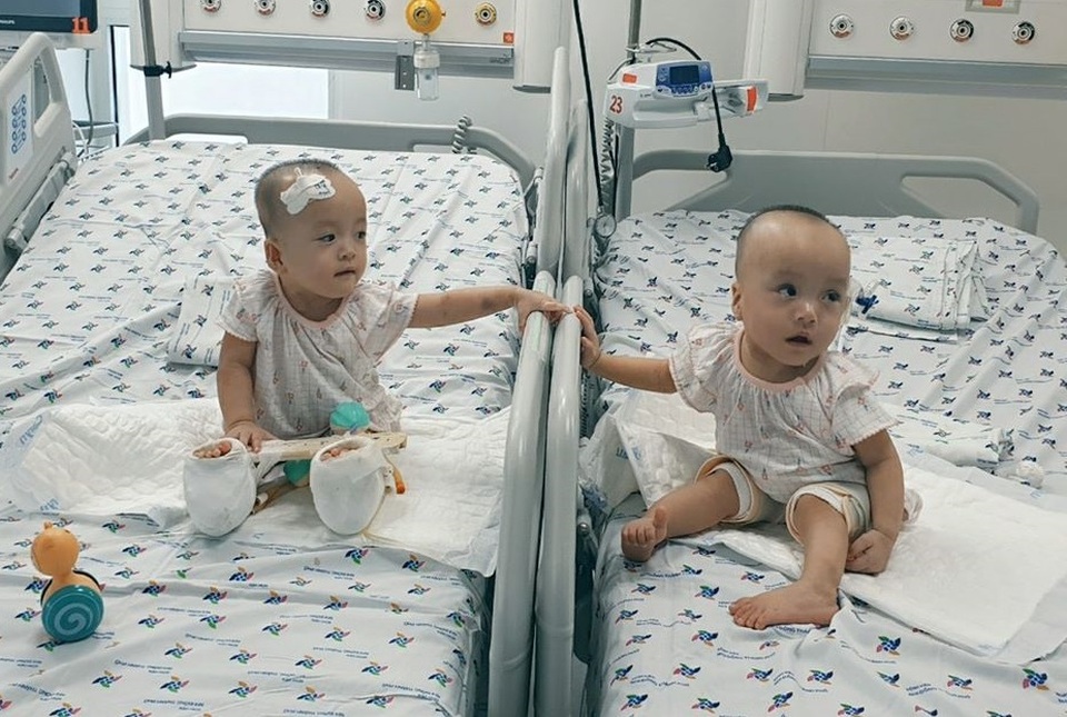 Sau tách dính, cặp Song Nhi lần đầu sum họp, bi bô trò chuyện - 7 Sau tách dính, cặp Song Nhi lần đầu sum họp, bi bô trò chuyện - 7