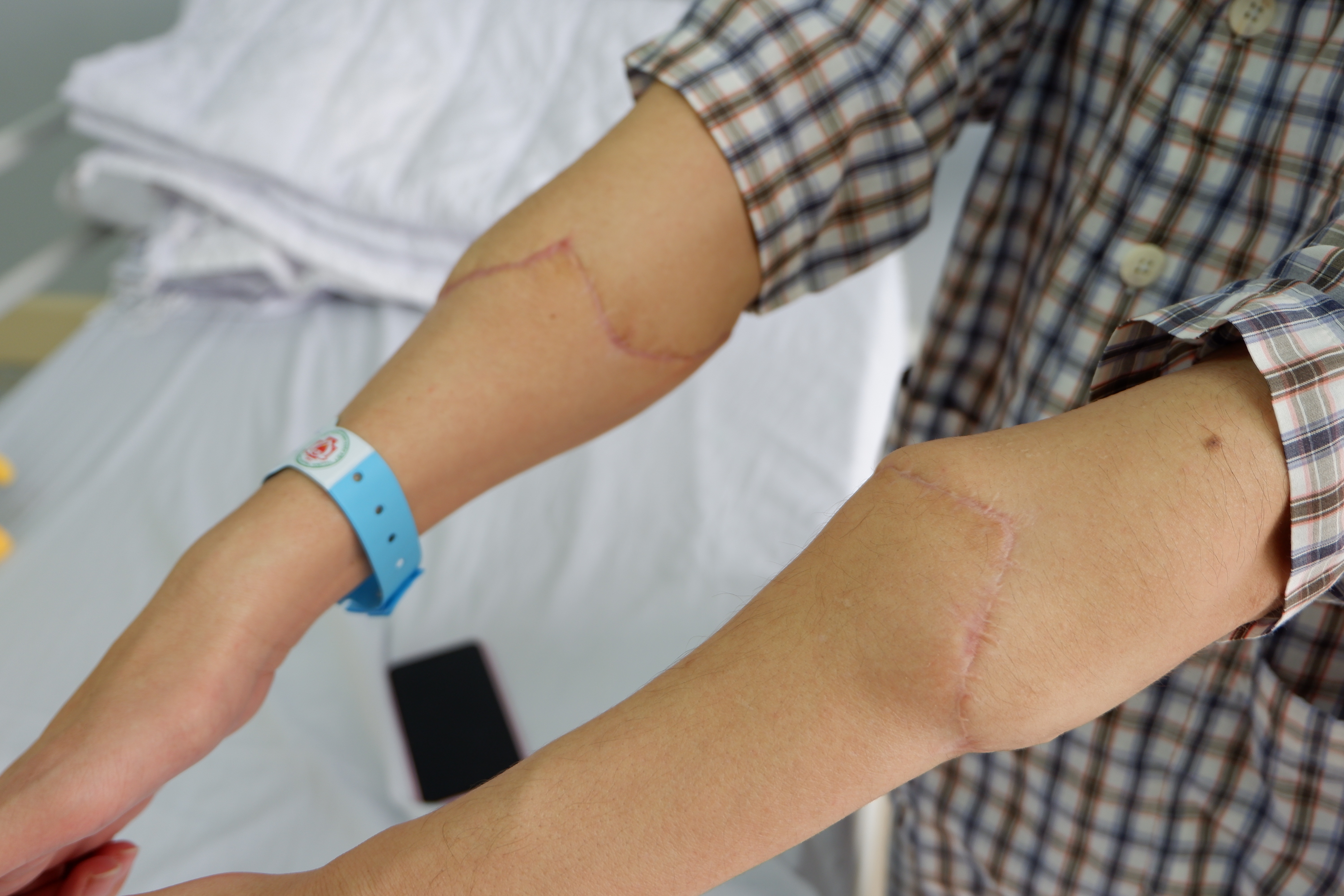 Từ thử thách mượn tay đến ca mổ đầu tiên trên thế giới của bác sĩ Việt - 10 Từ thử thách mượn tay đến ca mổ đầu tiên trên thế giới của bác sĩ Việt - 10