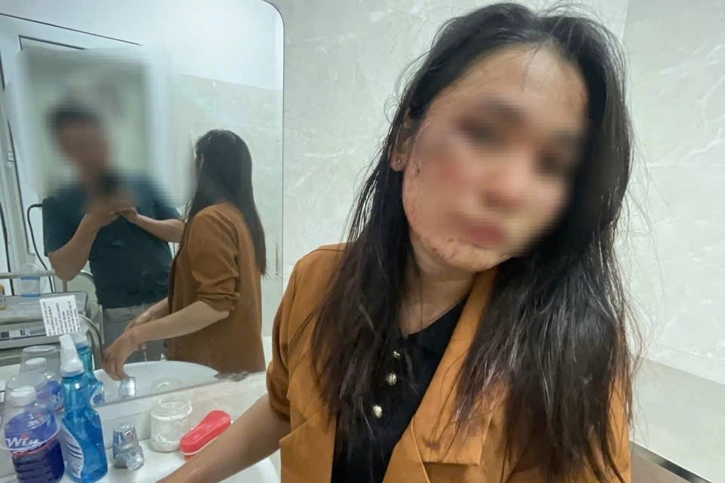 Công an vào cuộc vụ nữ nhân viên giao hàng tố bị khách đánh nhập viện - 2 Công an vào cuộc vụ nữ nhân viên giao hàng tố bị khách đánh nhập viện - 2