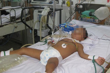 Bé 3 tuổi nguy kịch vì tiêm vắc-xin uốn ván không đủ liều