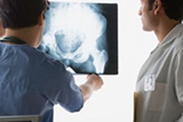 Dự đoán nguy cơ ung thư vú qua mật độ xương 