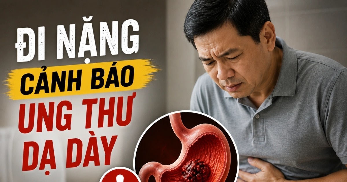 Dấu hiệu cảnh báo ung thư dạ dày khi đi vệ sinh