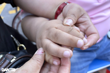 6 triệu người Việt mắc bệnh hiếm