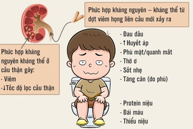 [Inforgraphics]: Nhận biết viêm họng do liên cầu khuẩn tan huyết nhóm A