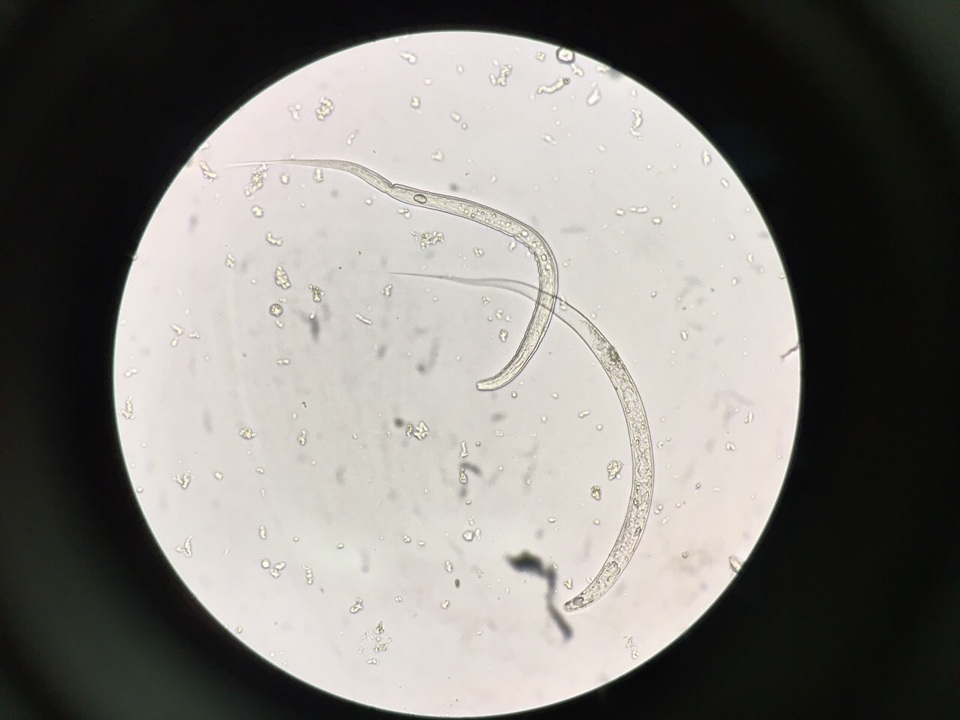 Rùng mình gắp giun lạ chưa từng có, dài tới 60cm ở tay chân bệnh nhân - 2