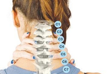 Cảnh giác nguy cơ thoái hóa đốt sống cổ ở dân văn phòng