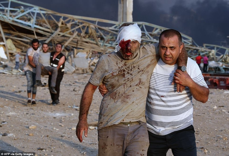 Sống sót kỳ diệu sau 30 giờ bị hất văng xuống biển vì vụ nổ Beirut - 1 Sống sót kỳ diệu sau 30 giờ bị hất văng xuống biển vì vụ nổ Beirut - 1