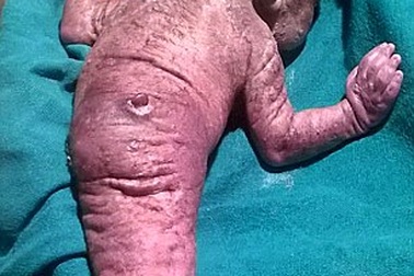 Em bé người cá xuất hiện tại Ấn Độ