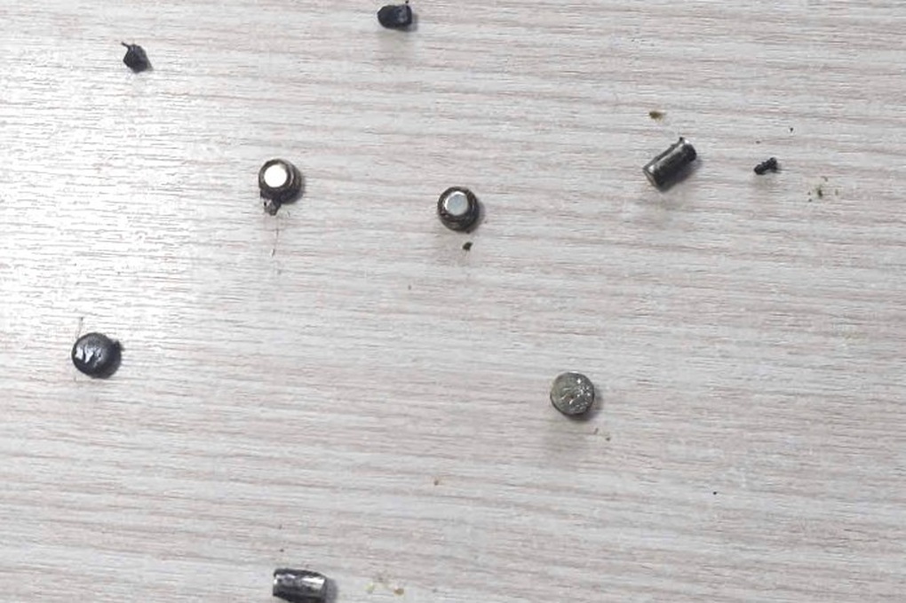 4-year-old boy suffered a perforated intestine after swallowing 10 batteries and magnets - 1 Bé trai 4 tuổi bị thủng ruột vì nuốt 10 cục pin và nam châm - 1