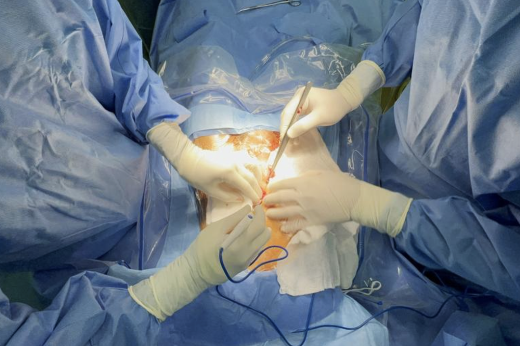 Cô gái 22 tuổi phải mổ hàng chục lần vì không có âm đạo - 1 Cô gái 22 tuổi phải mổ hàng chục lần vì không có âm đạo - 1