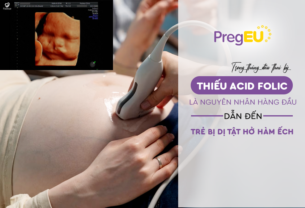 PregEU phối hợp cùng Operation Smile triển khai chiến dịch Yêu con, mẹ chọn PregEU - 2 PregEU phối hợp cùng Operation Smile triển khai chiến dịch Yêu con, mẹ chọn PregEU - 2