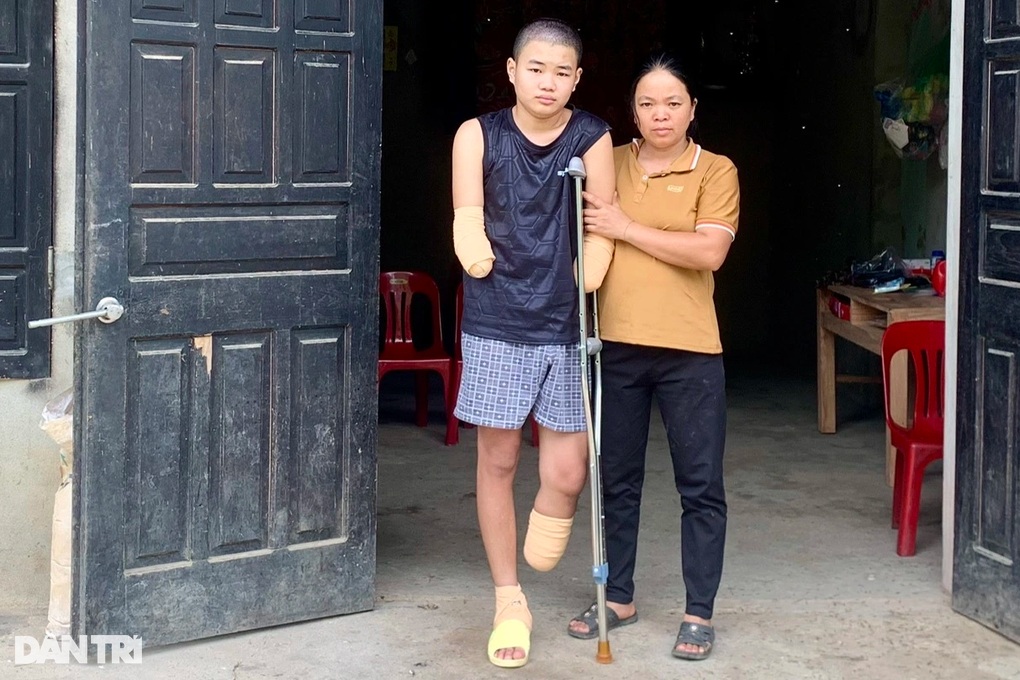 Trao hơn 817 triệu đồng đến cậu bé bị cắt cụt 2 tay và 1 chân vì bỏng điện - 2 Trao hơn 817 triệu đồng đến cậu bé bị cắt cụt 2 tay và 1 chân vì bỏng điện - 2