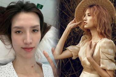 "Người mẫu cao nhất Việt Nam" Hồng Xuân phẫu thuật thay van tim