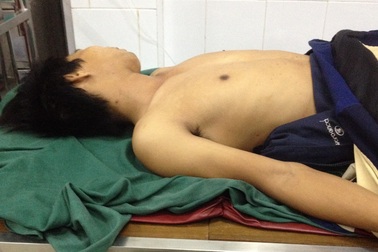 Bị thương vì nghịch súng