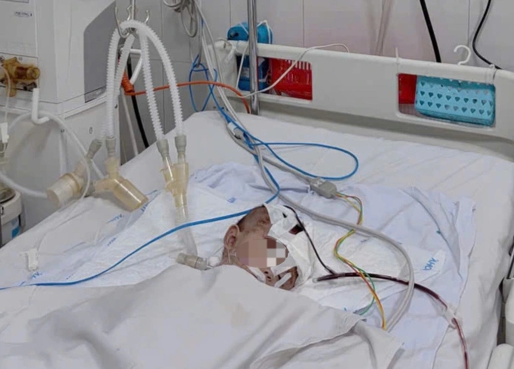 Bệnh viện báo động đỏ cấp cứu 7 người bị tai nạn giao thông nghiêm trọng - 2 Bệnh viện báo động đỏ cấp cứu 7 người bị tai nạn giao thông nghiêm trọng - 2