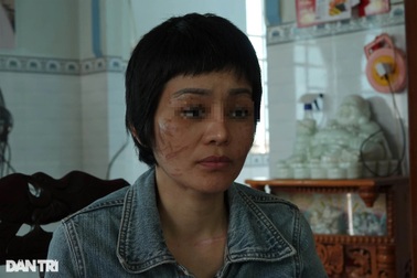 205 vết thương trên cơ thể thai phụ bị bạo hành dã man ở Hải Dương