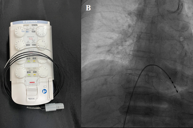 Cấp cứu thành công 2 bệnh nhân bị nhồi máu cơ tim cấp nặng