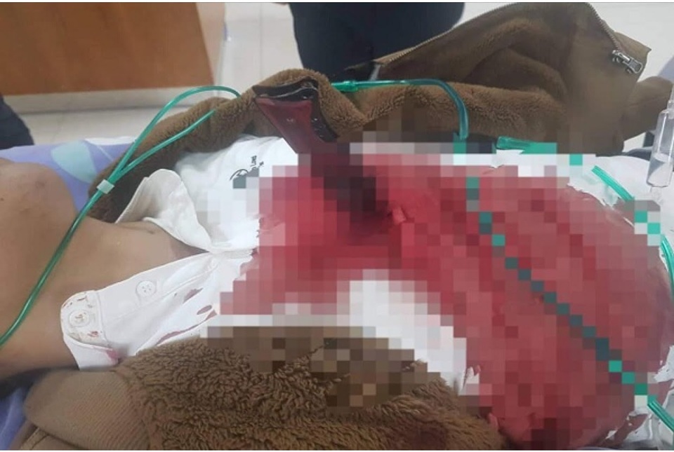 Bắt kẻ dùng dao đâm nam thanh niên thấu tim - 1