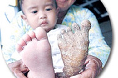 Củ sắn giống chân người