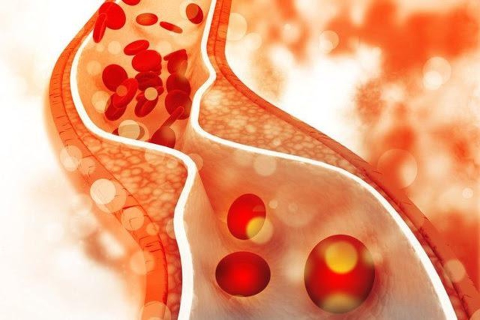 Thứ trưởng Bộ Y tế Nguyễn Trường Sơn báo động thực trạng thừa cholesterol của người Việt - 2 Thứ trưởng Bộ Y tế Nguyễn Trường Sơn báo động thực trạng thừa cholesterol của người Việt - 2