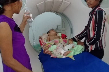 Lọt vào căm (nan hoa) xe máy, bé 11 tháng tuổi nguy kịch