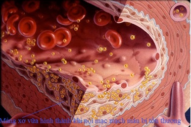 ALA - “Chìa khóa” hóa giải biến chứng tiểu đường