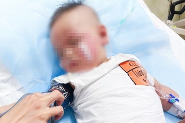 TPHCM: Bé trai 13 tháng tuổi nghẹt thở nguy kịch sau khi ăn bánh flan