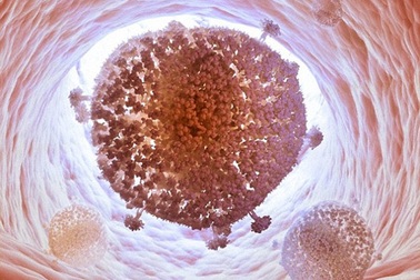 Đã tìm ra cách loại bỏ vi rút HIV khỏi cơ thể