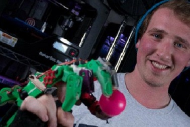 Bàn tay giả in 3D giá 15 USD