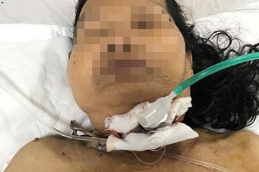 Cụ bà 73 tuổi bị dao đâm xuyên cổ vì trượt ngã trong lúc làm cơm ngày lễ