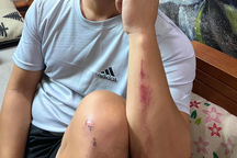 Nhóm thanh niên hàng đêm đi ném vỏ chai bia "trêu" người đi đường