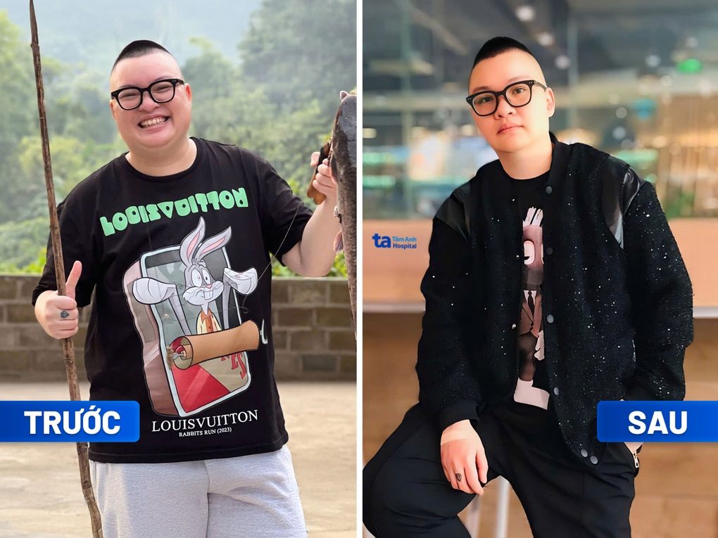 Hơn 1.000 người giảm cân an toàn theo chuẩn y khoa tại bệnh viện Tâm Anh - 1 Hơn 1.000 người giảm cân an toàn theo chuẩn y khoa tại bệnh viện Tâm Anh - 1