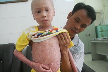 Cậu bé 9 tuổi có làn da như... cụ già