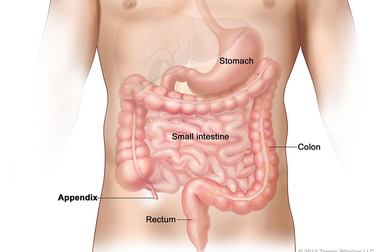 Mắc ung thư ung thư ruột thừa sống được bao lâu?