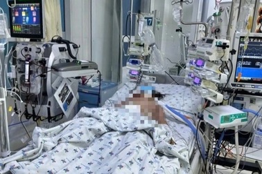 Hai trẻ sốt xuất huyết biến chứng nặng, bác sĩ nêu dấu hiệu cần nhập viện