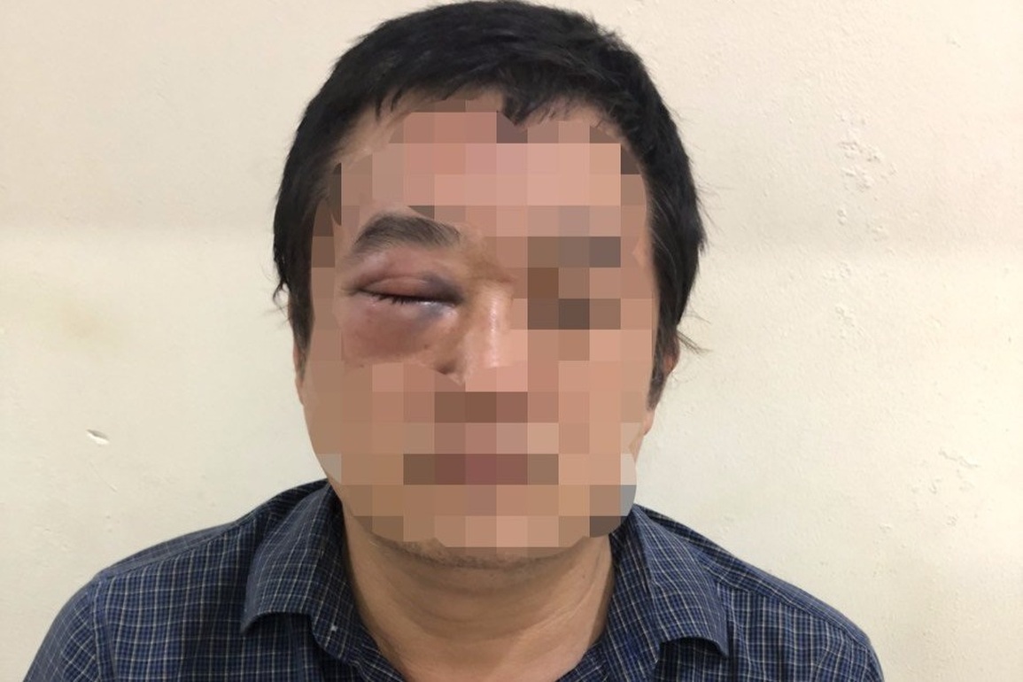 Bắt băng nhóm giang hồ đánh hội đồng một giám đốc ở TPHCM - 3 Bắt băng nhóm giang hồ đánh hội đồng một giám đốc ở TPHCM - 3
