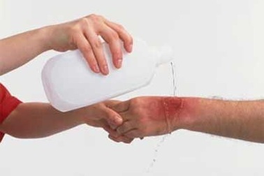 Xử trí vết thương do bỏng 