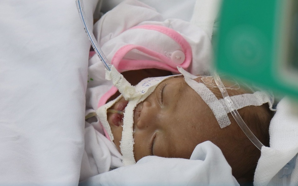 Hài nhi bị bỏ rơi trong sân chùa đang rất cần sự chung tay của cộng đồng - 3 Hài nhi bị bỏ rơi trong sân chùa đang rất cần sự chung tay của cộng đồng - 3