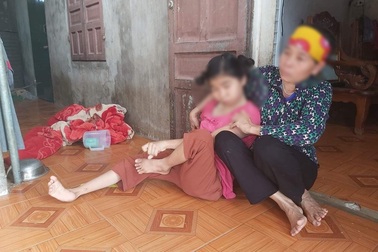 Vụ hiếp dâm thiếu nữ tàn tật: Bản án chưa tương xứng hành vi phạm tội!