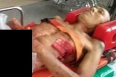 Dùng dao rọc giấy tự cắt “của quý” sau khi bị nhiều cô gái từ chối