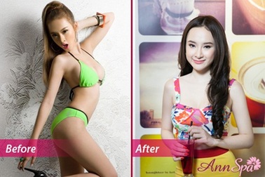 Annspa-ưu đãi làm đẹp 20/10 với quà tặng lên tới 10 triệu đồng