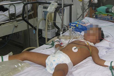 Bé 3 tuổi thủng ruột do nuốt nam châm dính sắt