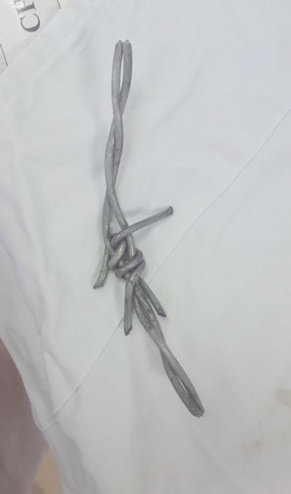 Đi xe đạp điện bị ngã, thiếu nữ 16 tuổi bị đoạn dây thép gai cắm vào cổ - 2 Đi xe đạp điện bị ngã, thiếu nữ 16 tuổi bị đoạn dây thép gai cắm vào cổ - 2