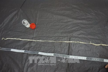 Nội soi gắp thành công sán xơ mít dài 1,2 mét