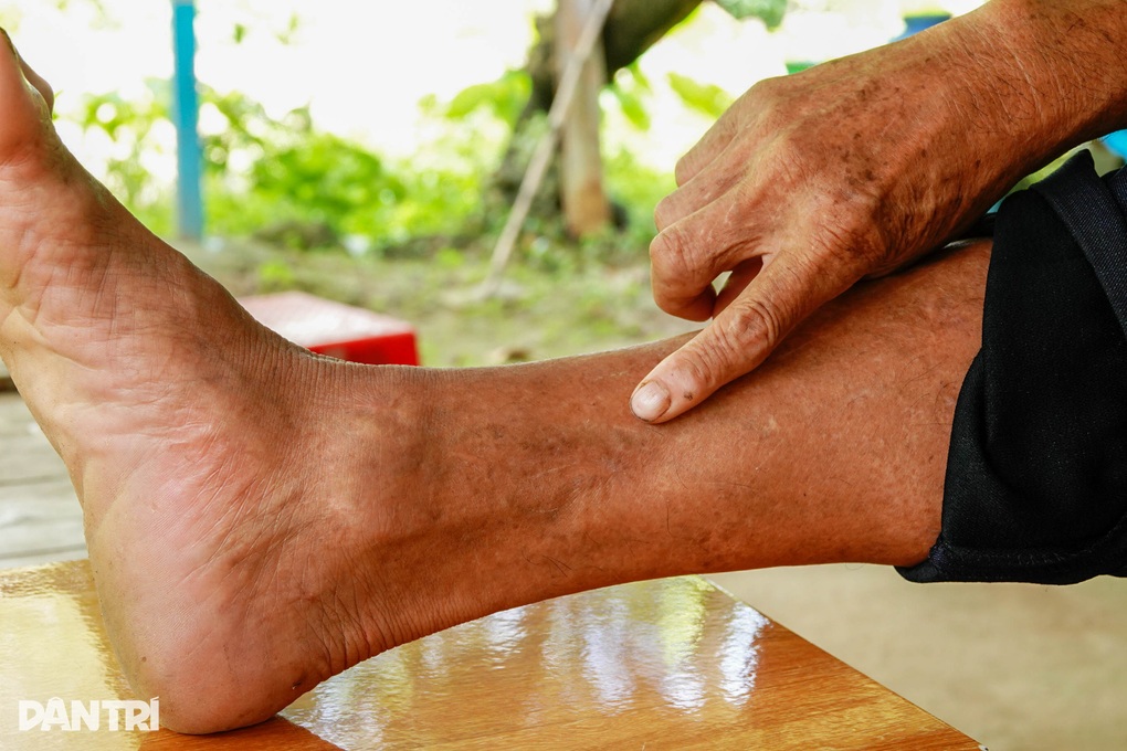 Chuyện vị thương binh già và cuộc đời đầy tự hào - 2 Chuyện vị thương binh già và cuộc đời đầy tự hào - 2
