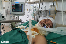 Xin cứu giúp chàng trai nghèo hiếu thảo bị phóng điện như ngọn đuốc sống